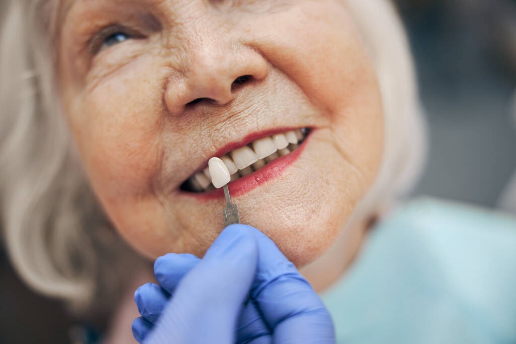Checking Shade of Tooth when picking for the Dental crown for the implants - Getting Cheap Dental Implants
